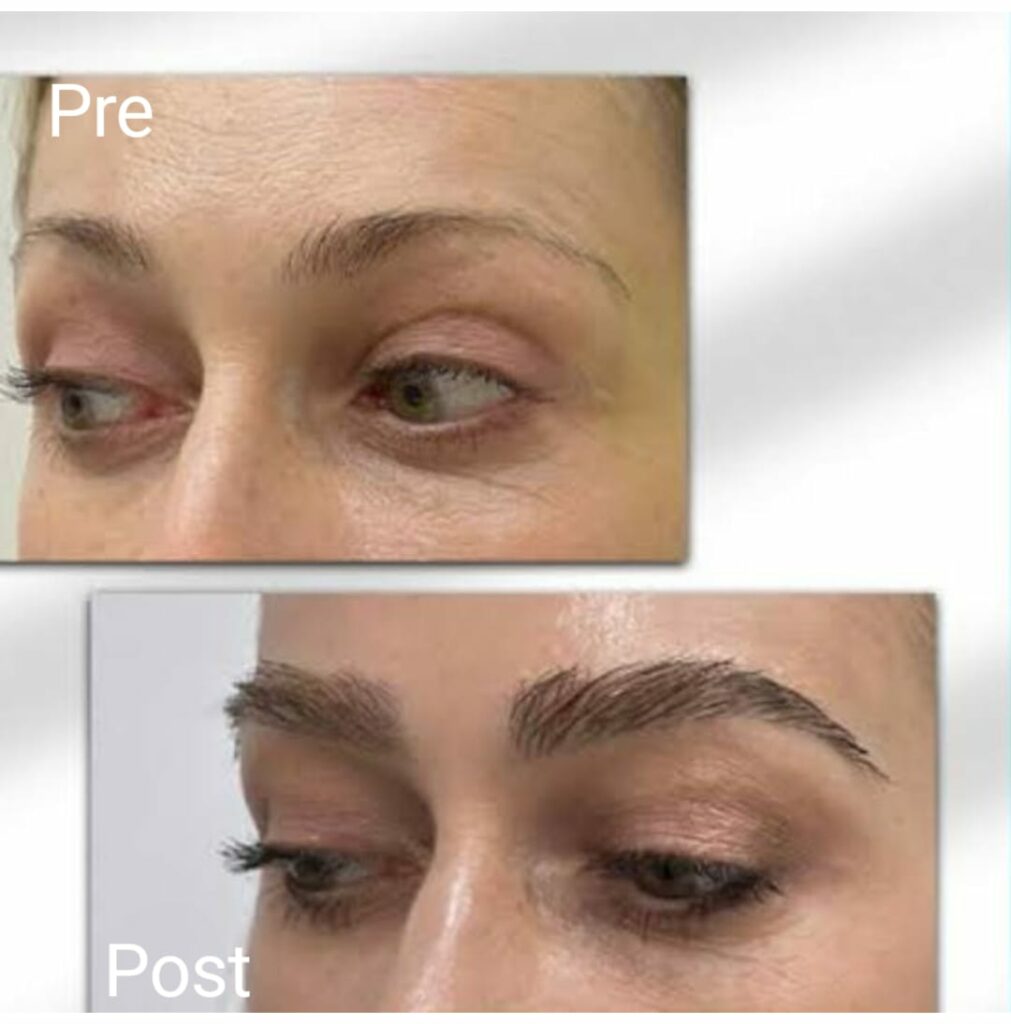 زراعة الحواجب في الغردقة